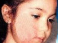 /album/fotogaleria/rostro-maltratado-jpg/
